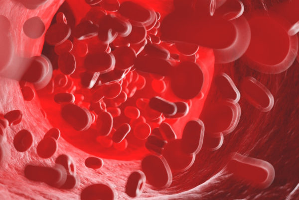 how to prevent blood clots